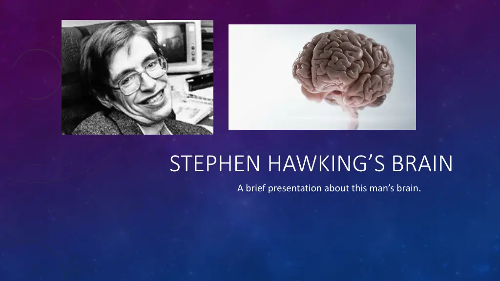 stephen hawking s brain