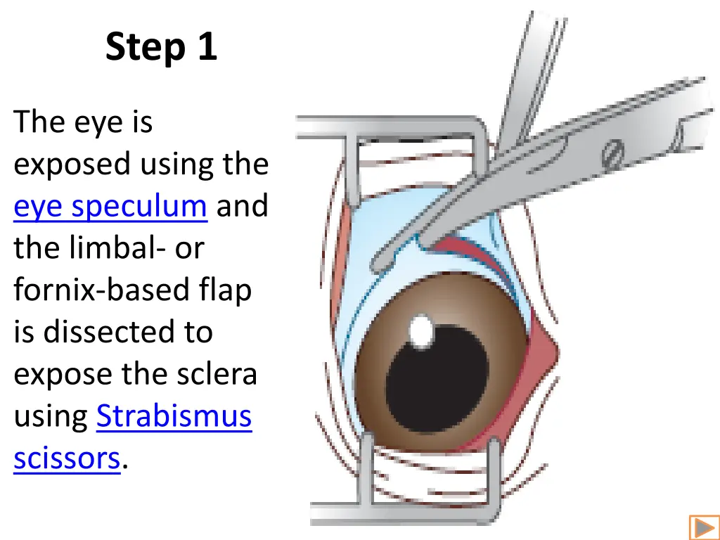 step 1