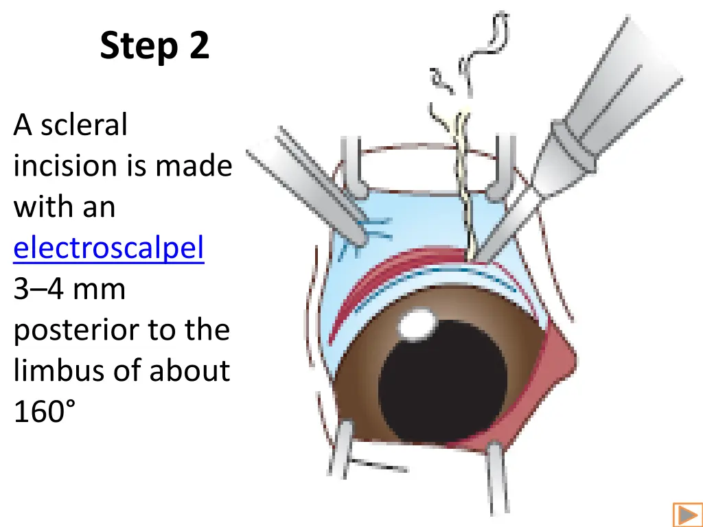 step 2