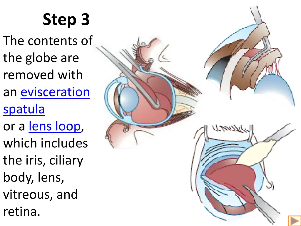 step 3