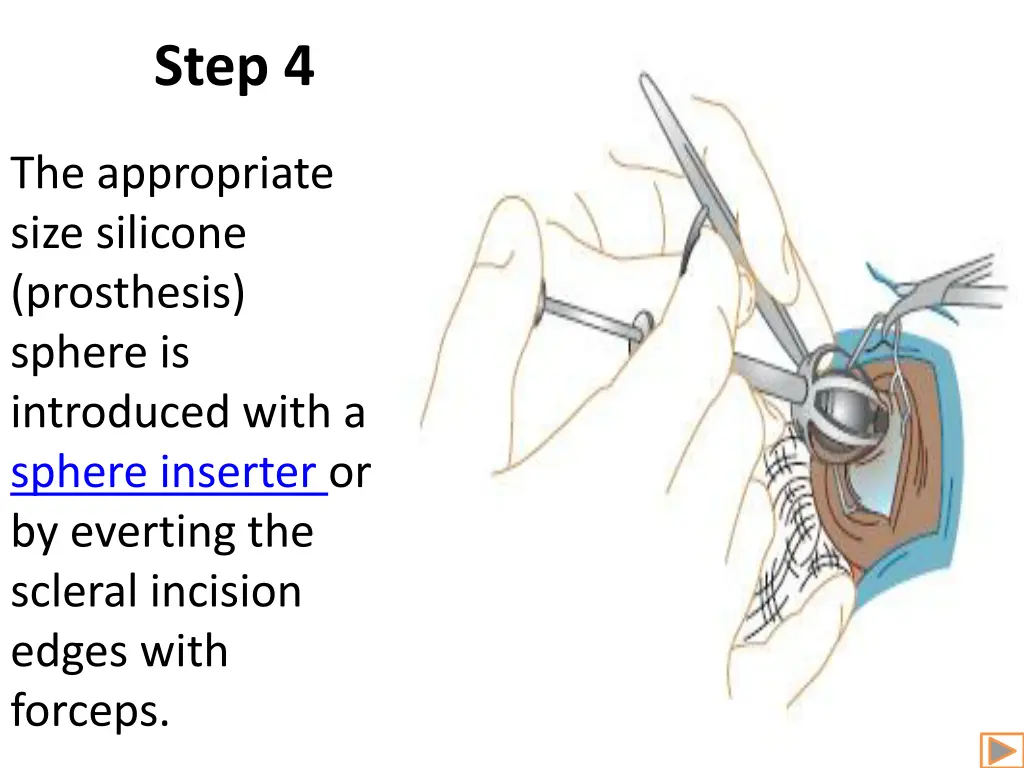step 4