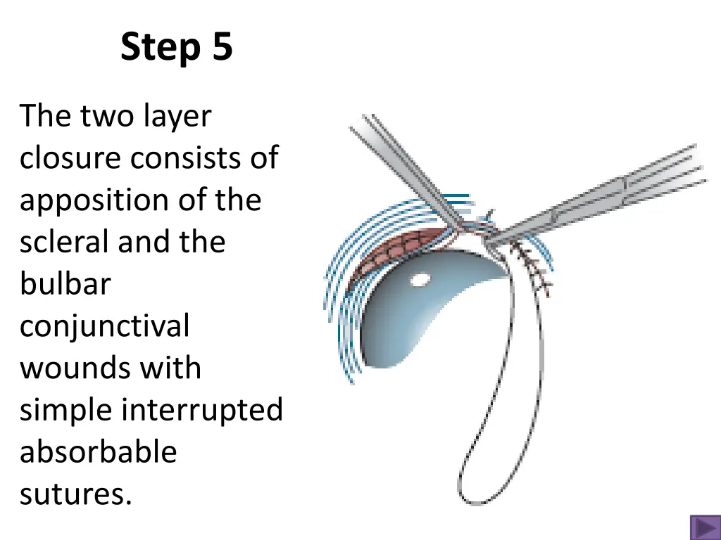 step 5