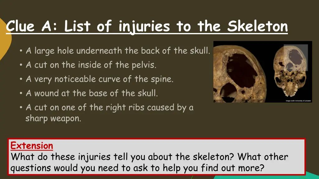 clue a list of injuries to the skeleton