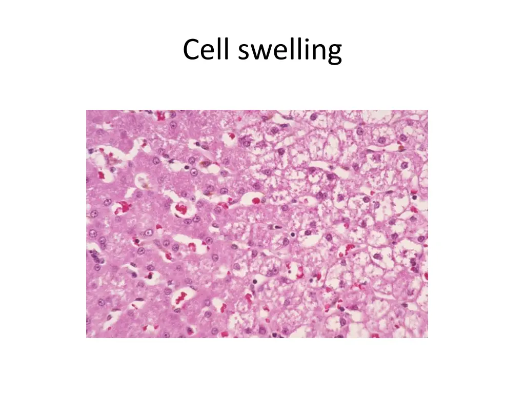cell swelling 2