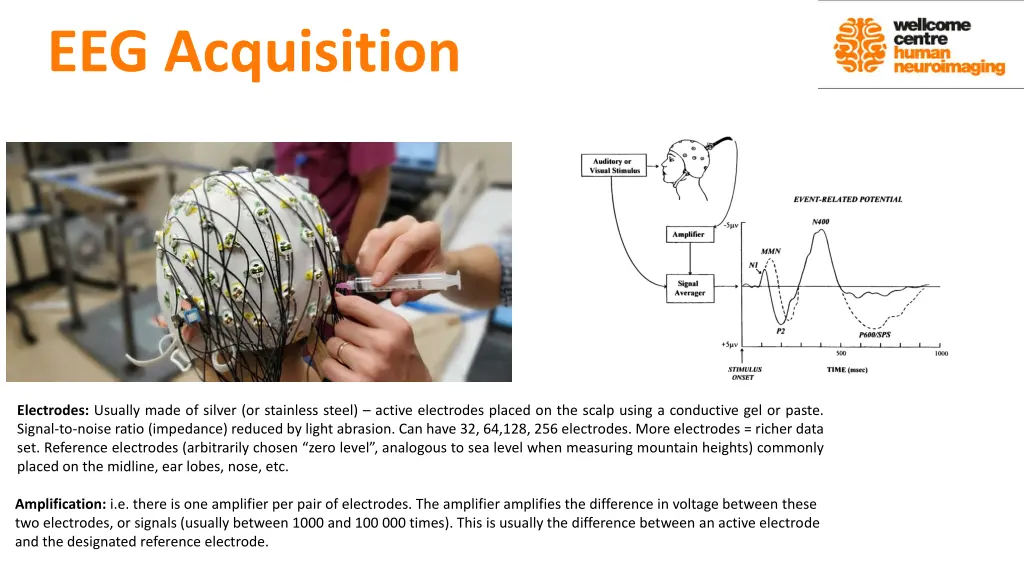 eeg acquisition