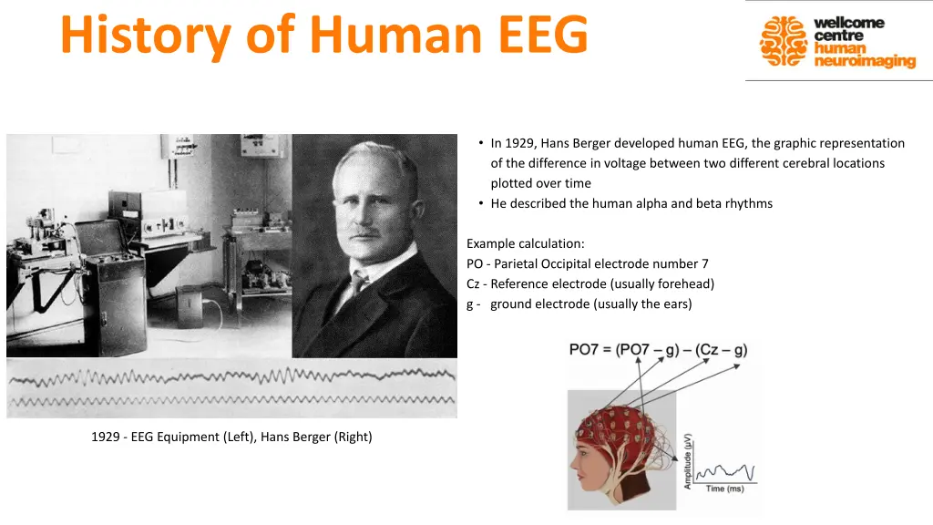 history of human eeg