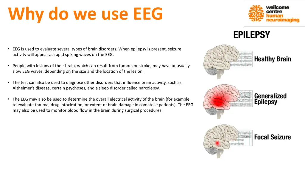 why do we use eeg