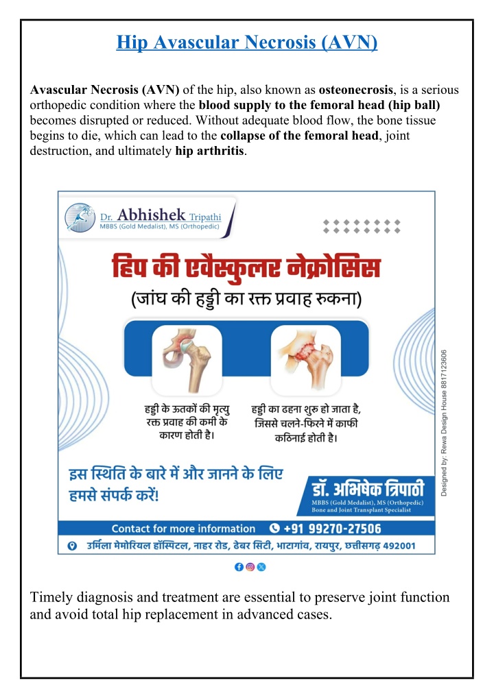 hip avascular necrosis avn