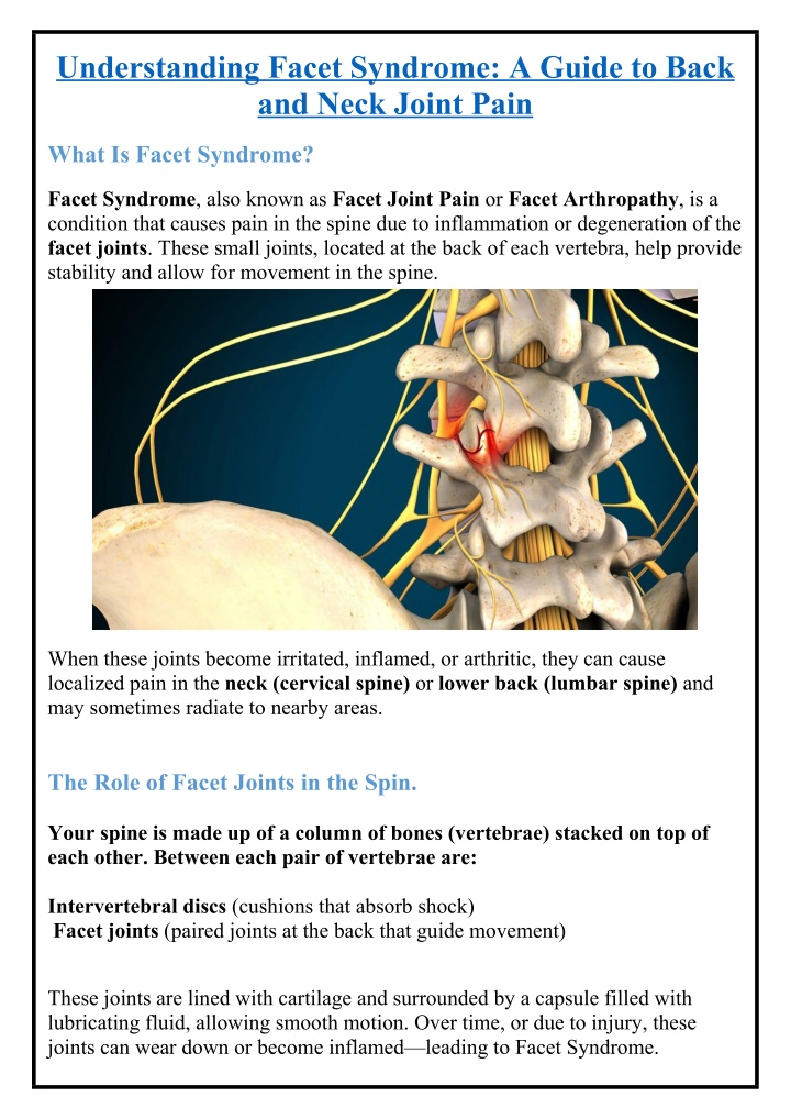 understanding facet syndrome a guide to back