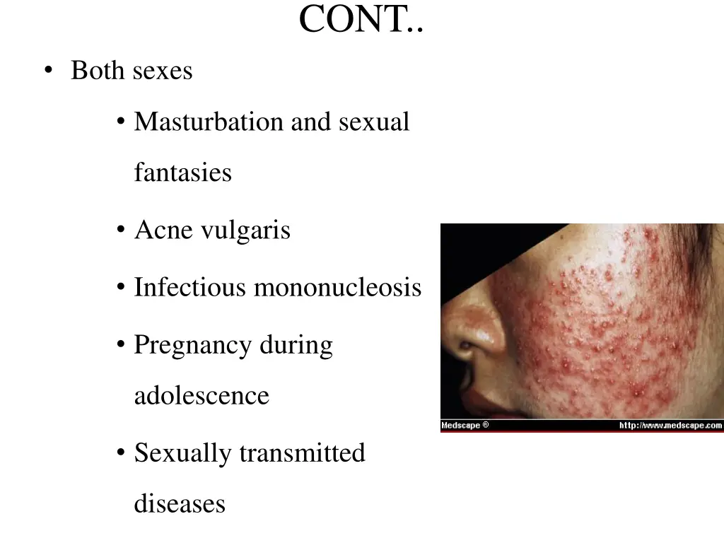 slide28