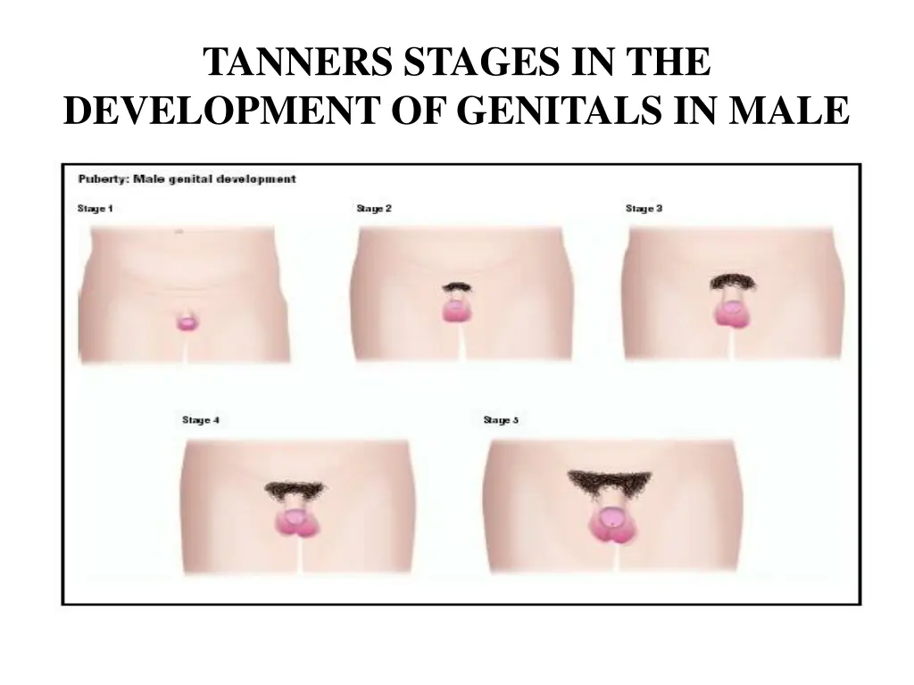 tanners stages in the development of genitals