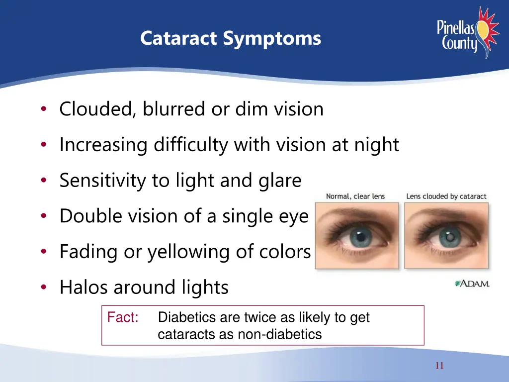 cataract symptoms
