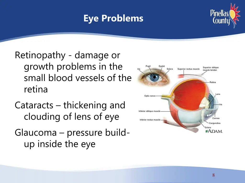 eye problems