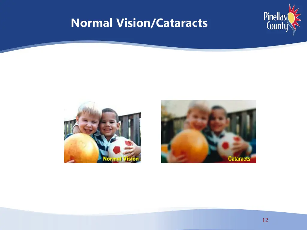 normal vision cataracts