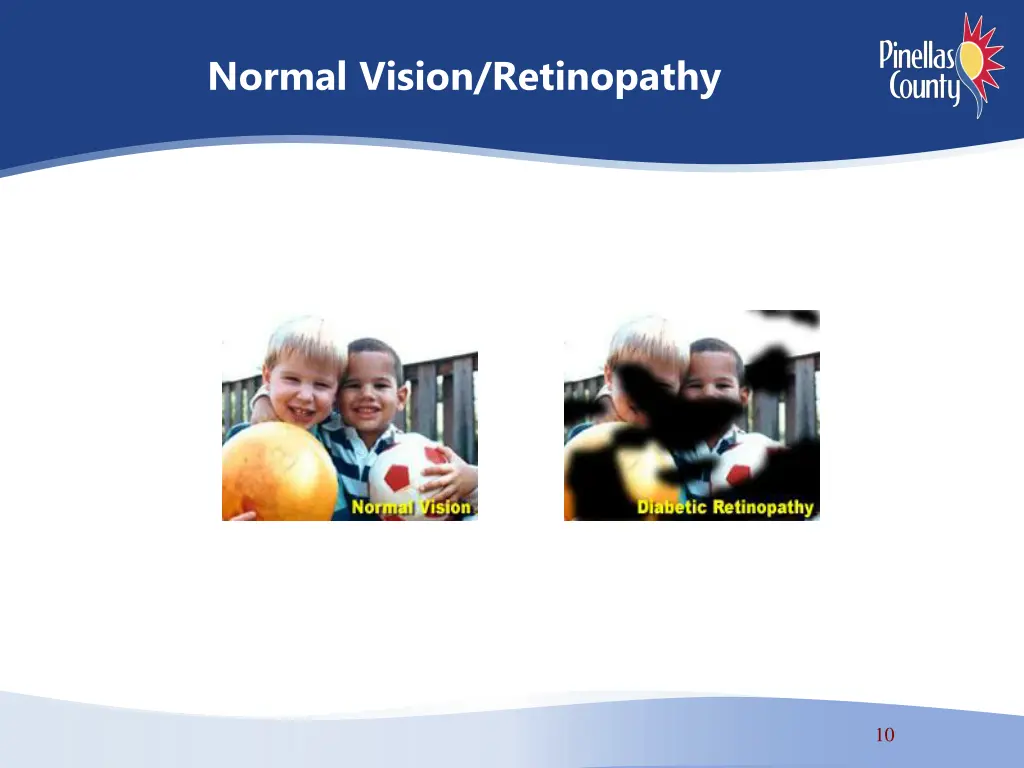 normal vision retinopathy