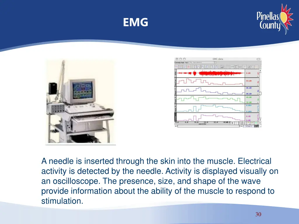 slide30