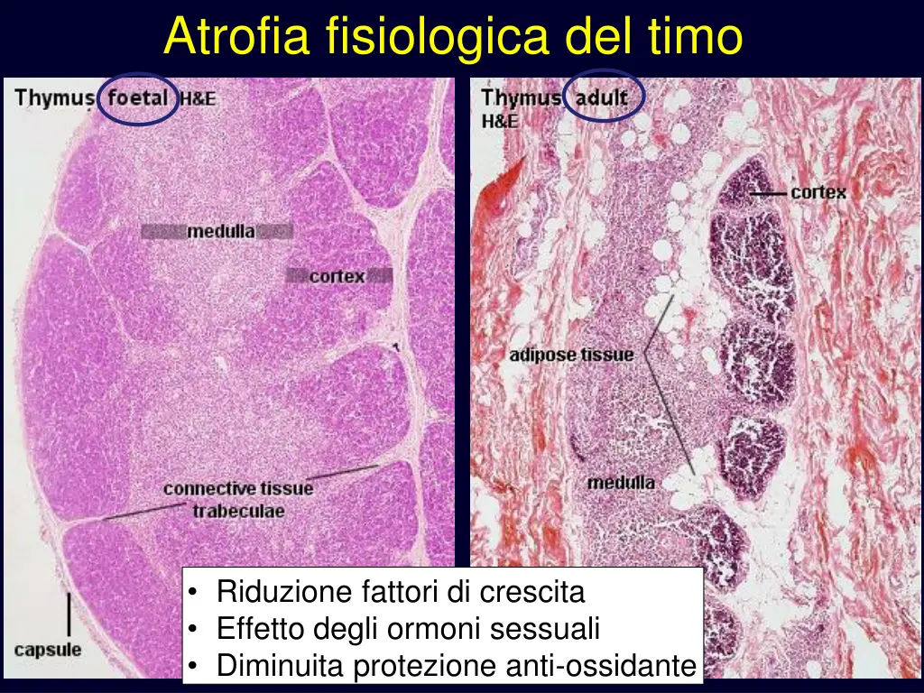 atrofia fisiologica del timo