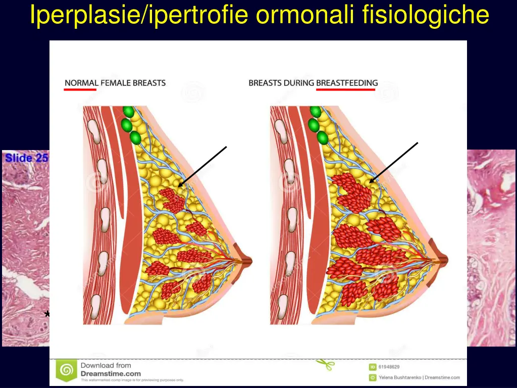 iperplasie ipertrofie ormonali fisiologiche