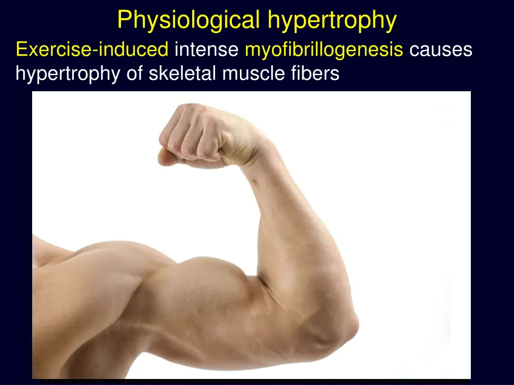 physiological hypertrophy exercise induced