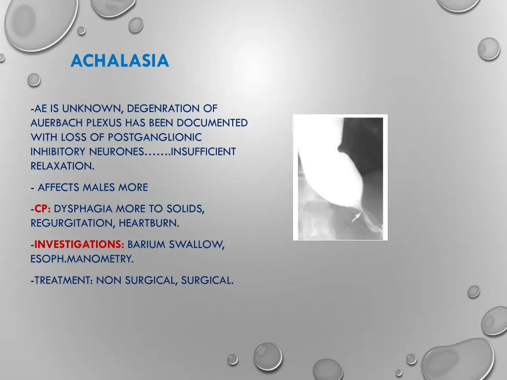achalasia