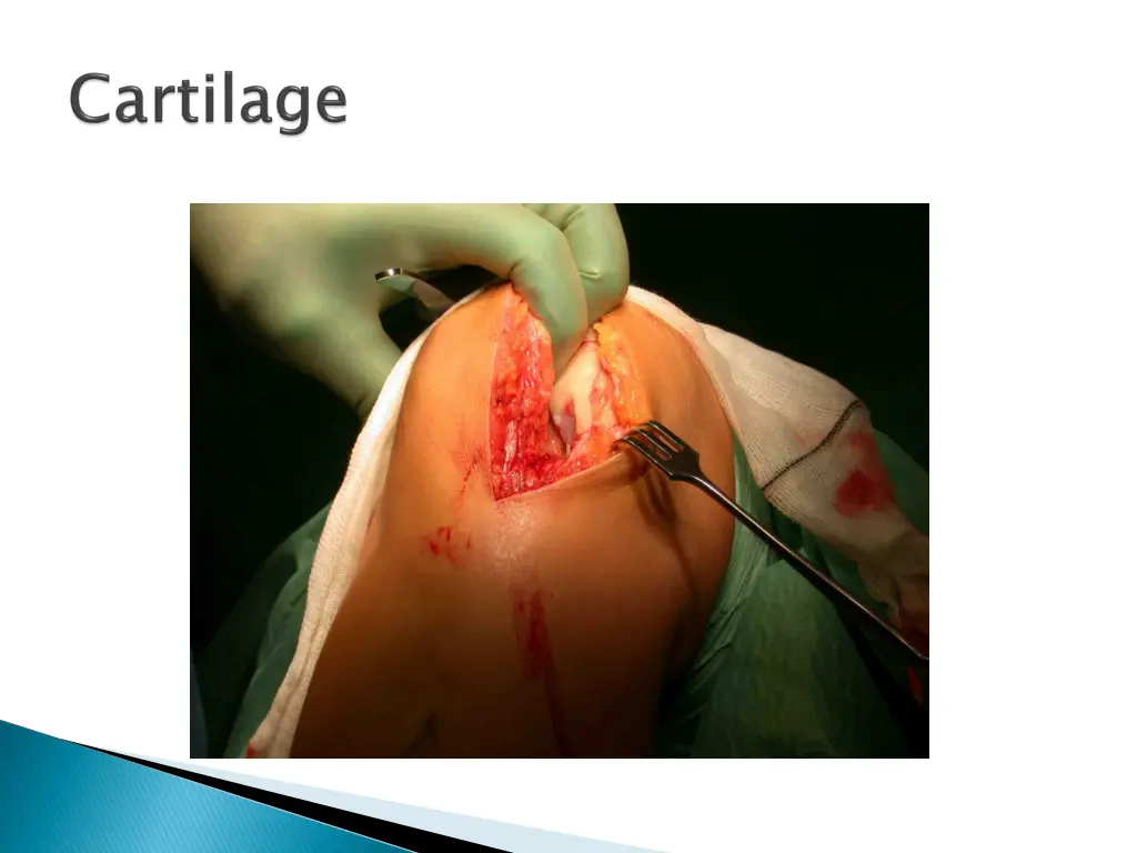 slide7