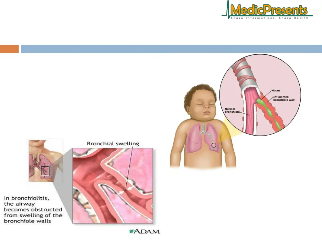 slide4