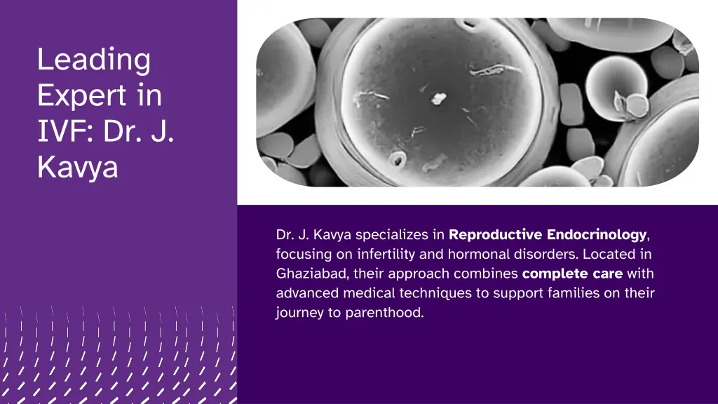 leading expert in ivf dr j kavya