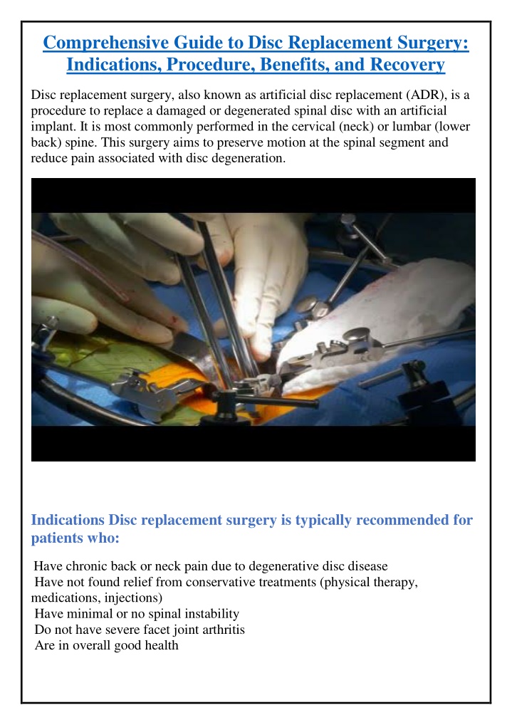 comprehensive guide to disc replacement surgery