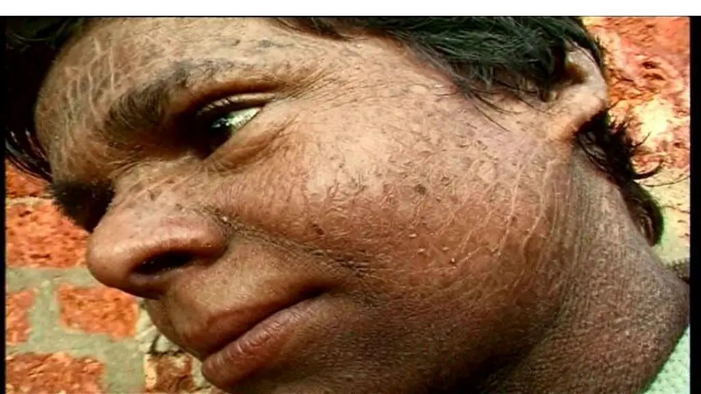 slide20