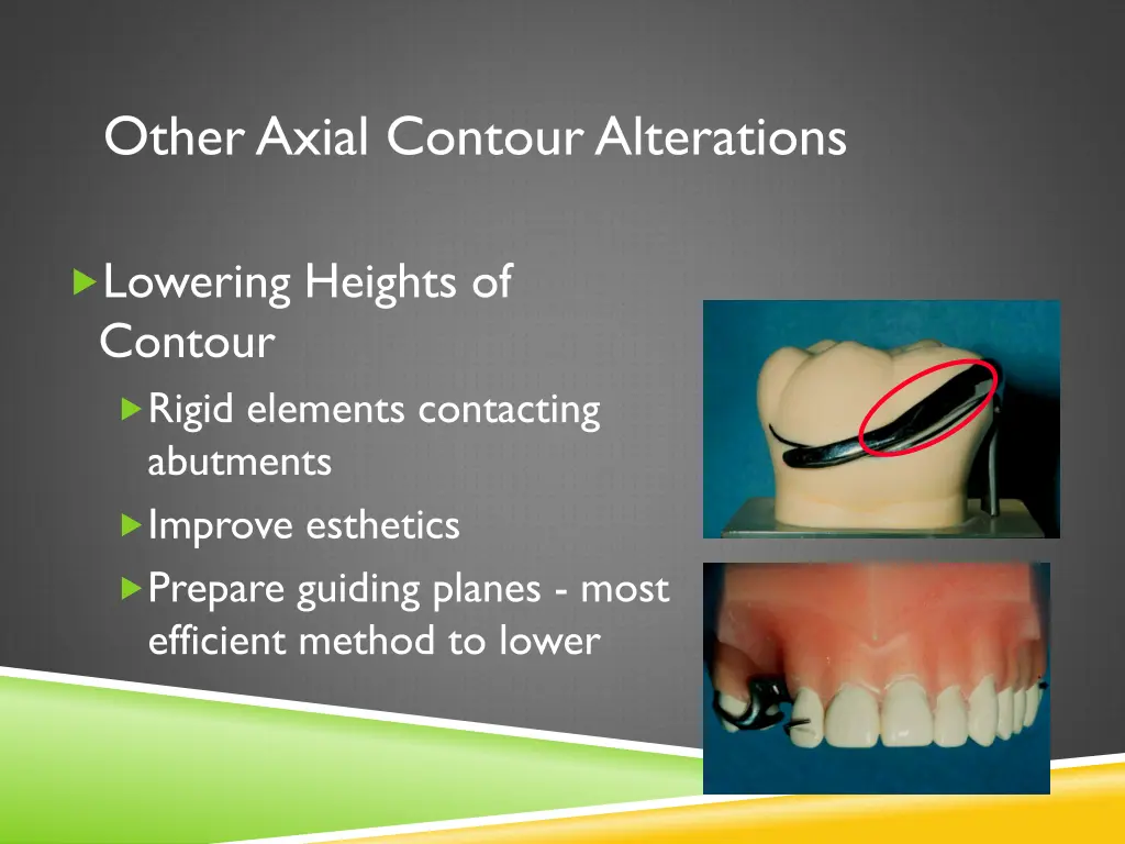 other axial contour alterations