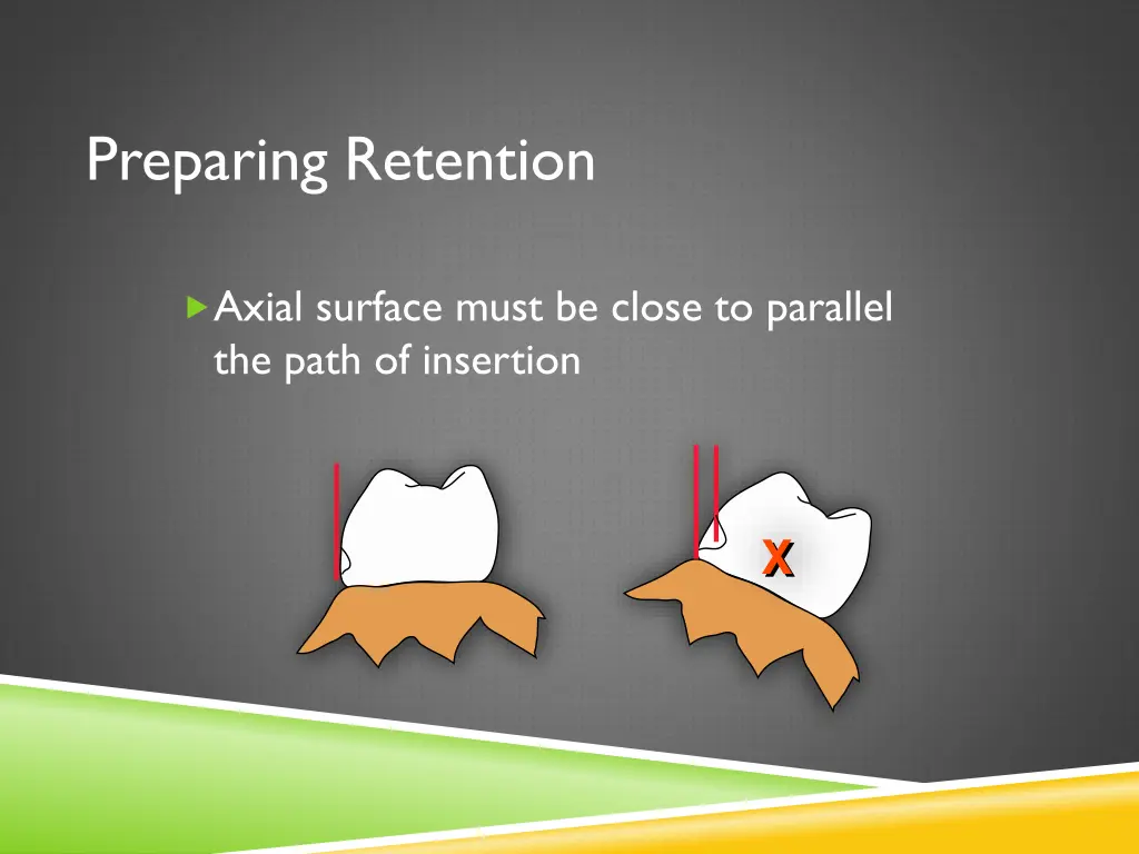 preparing retention