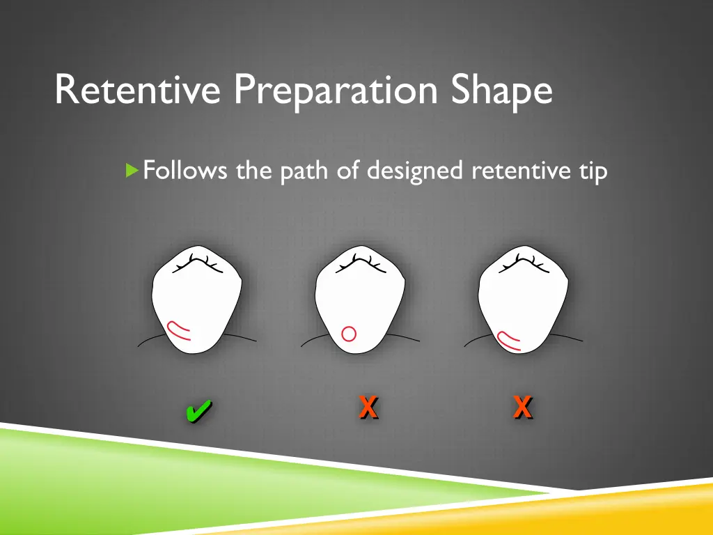 retentive preparation shape