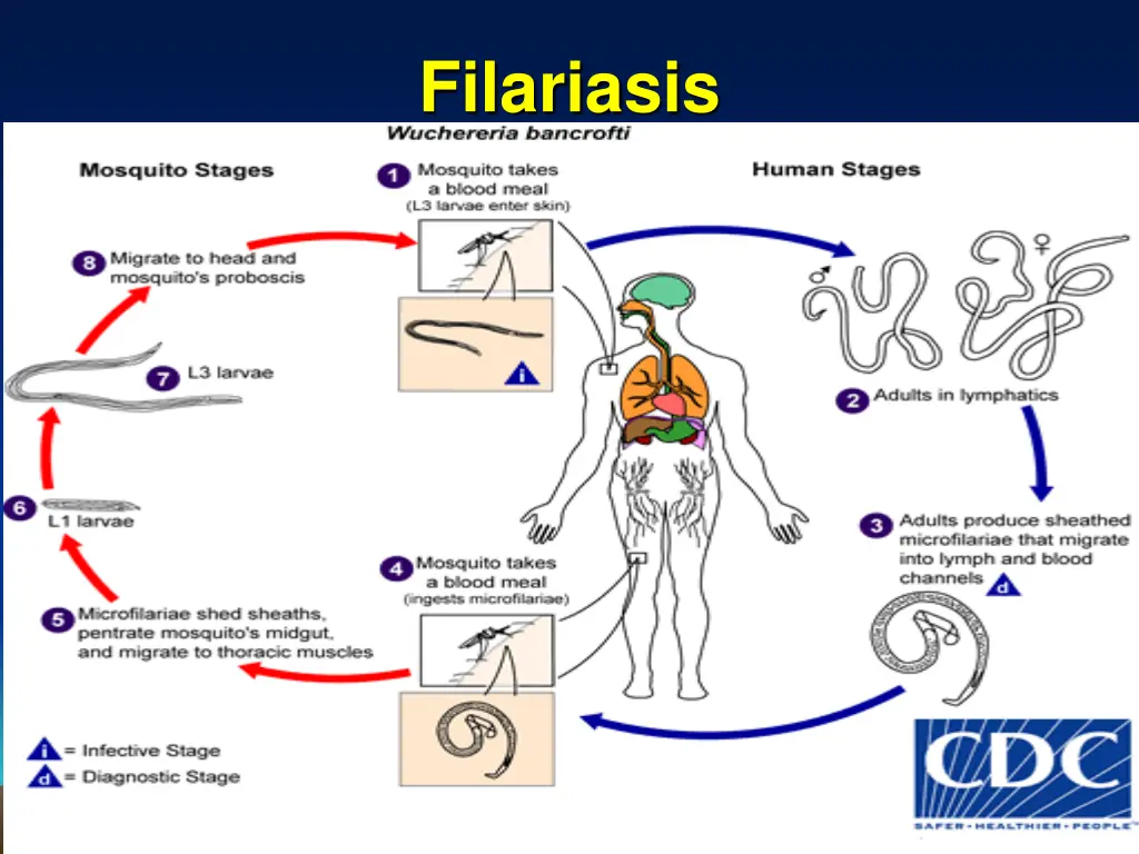 filariasis