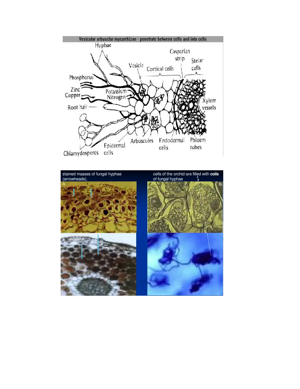 stained masses of fungal hyphae arrowheads