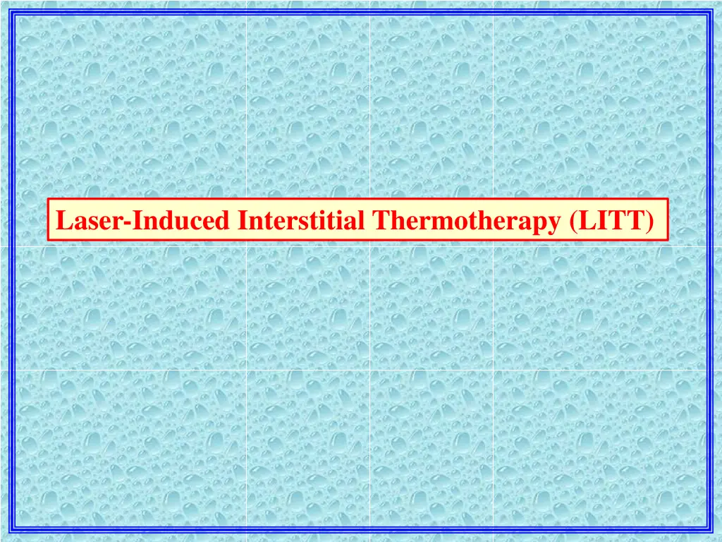 laser induced interstitial thermotherapy litt