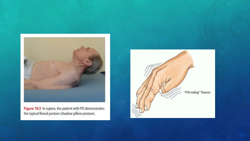 slide7