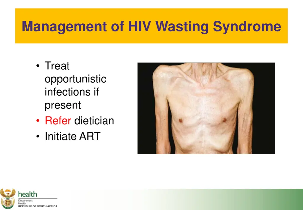 management of hiv wasting syndrome