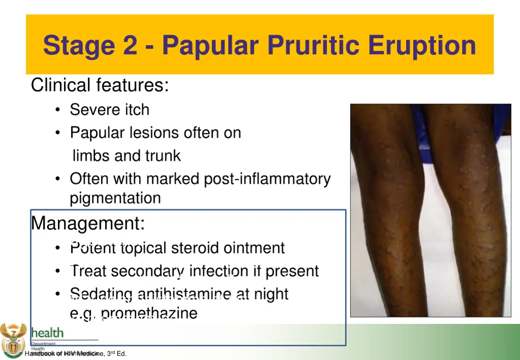 stage 2 papular pruritic eruption
