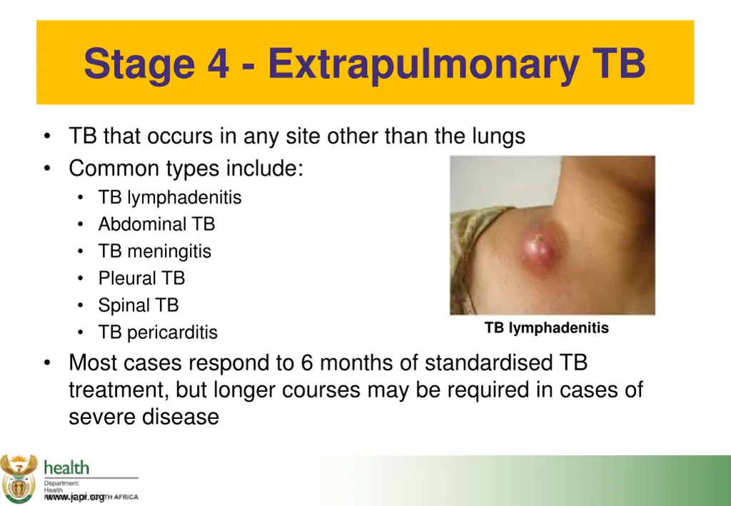 stage 4 extrapulmonary tb tb that occurs