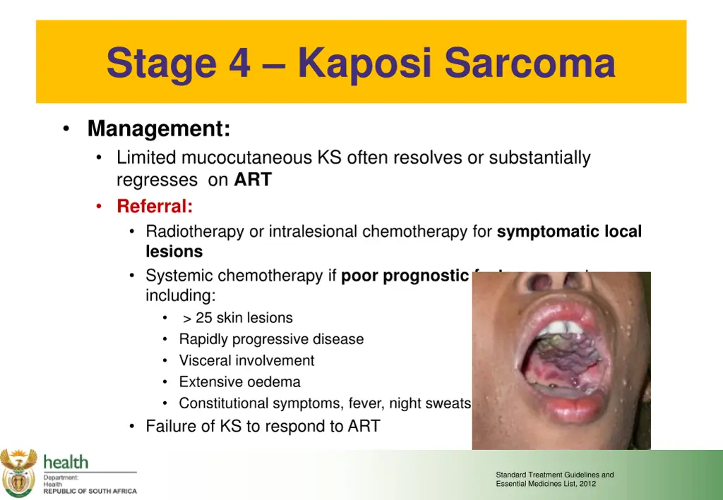 stage 4 kaposi sarcoma 1