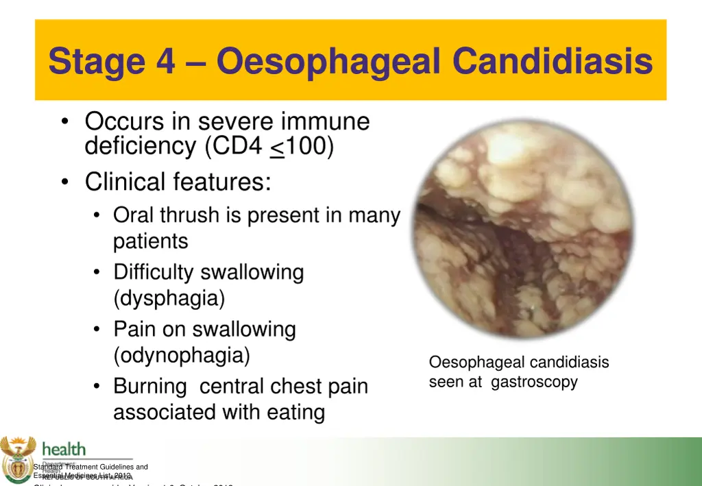 stage 4 oesophageal candidiasis