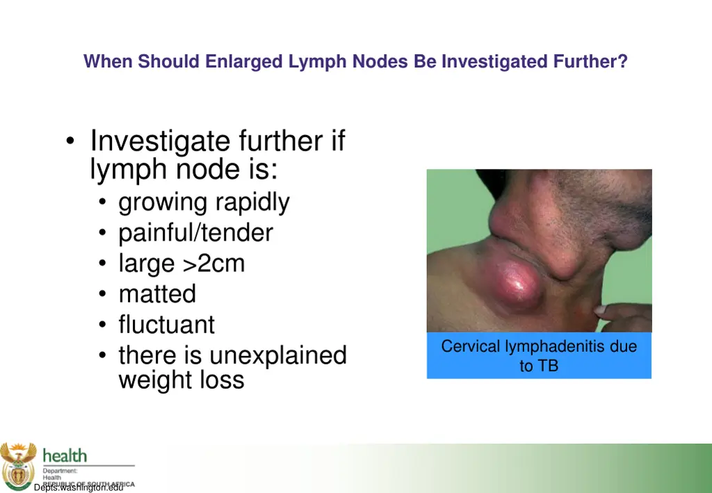 when should enlarged lymph nodes be investigated