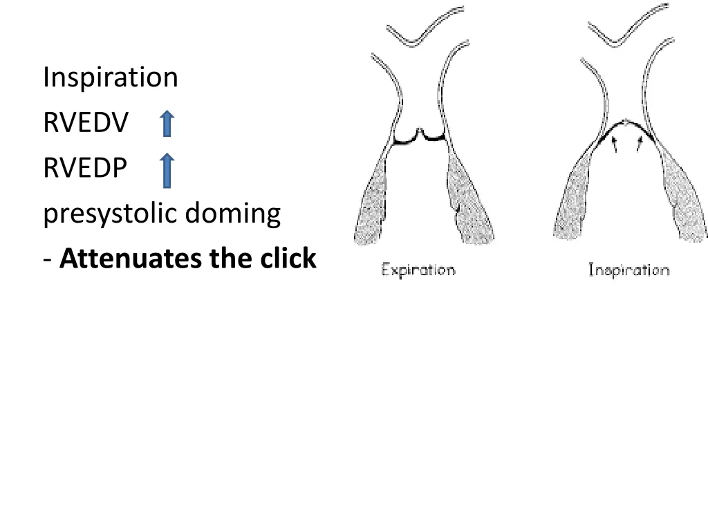 inspiration rvedv rvedp presystolic doming