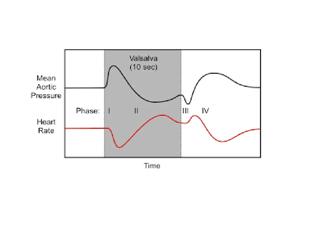 slide32