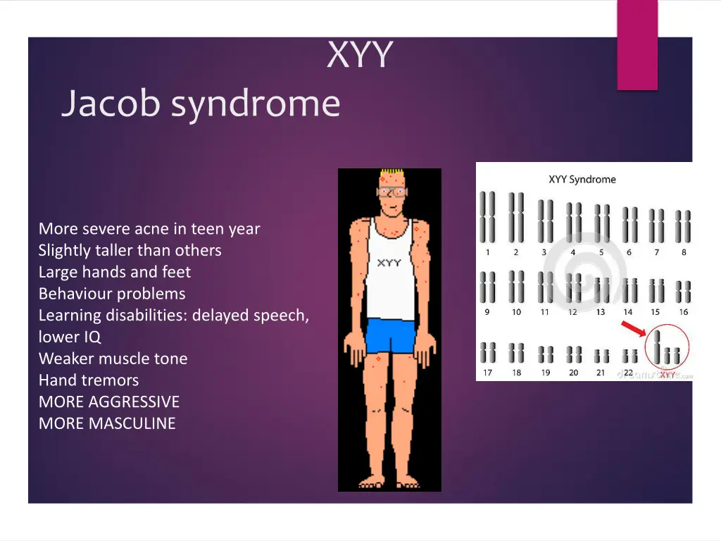 slide7