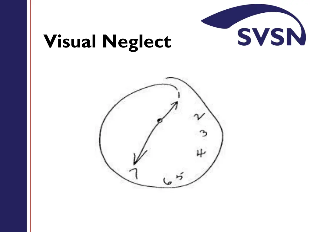 visual neglect 1