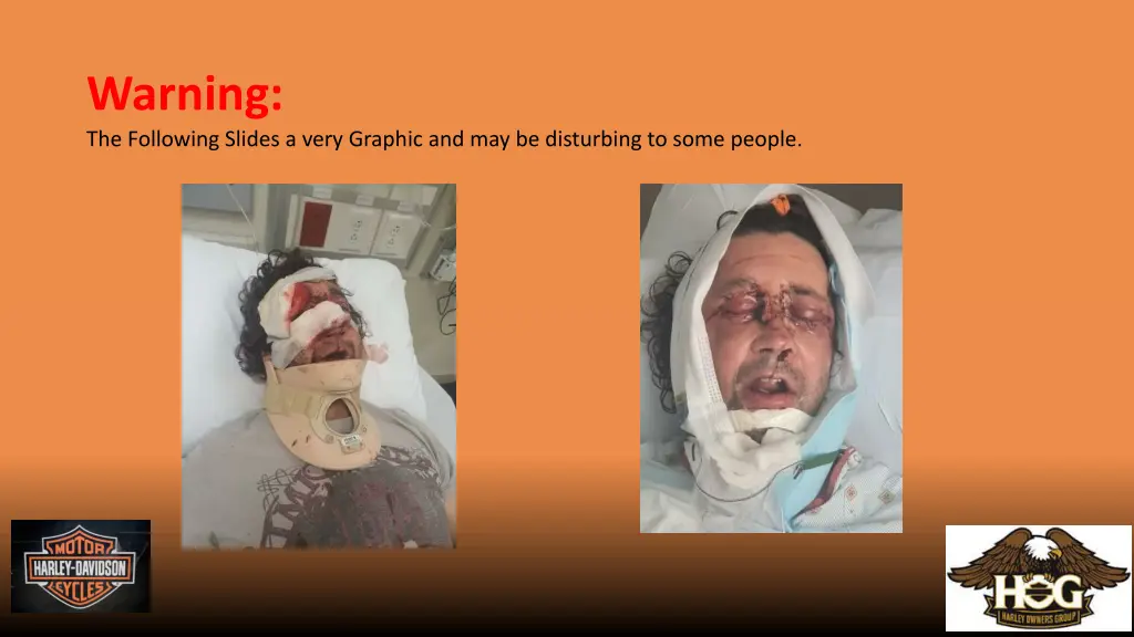 warning the following slides a very graphic