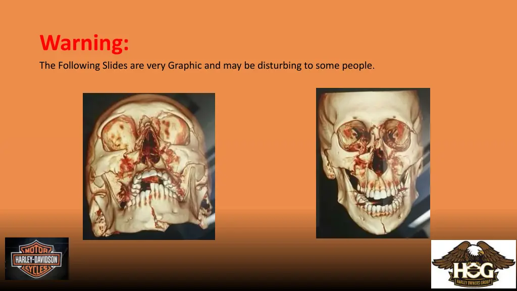 warning the following slides are very graphic