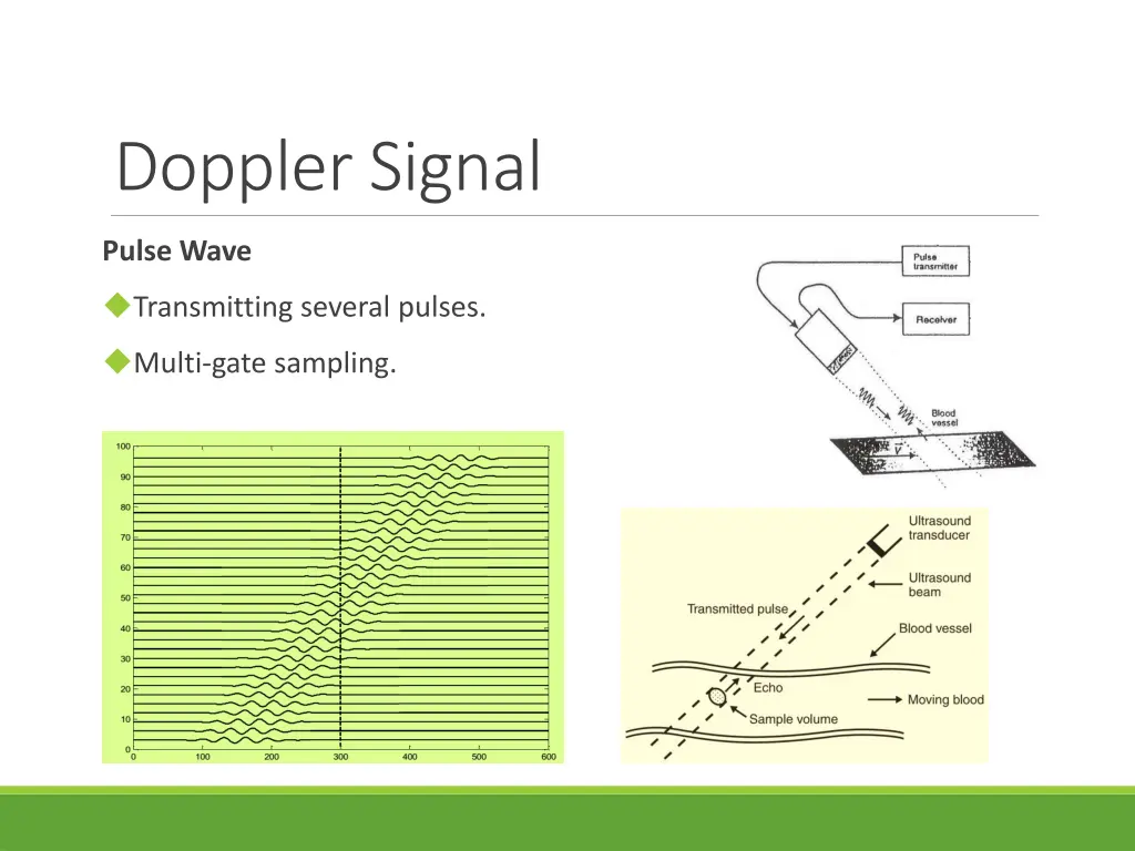 doppler signal 5