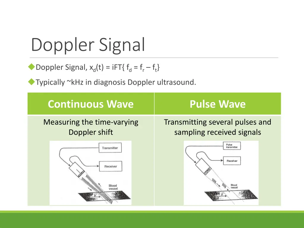 doppler signal